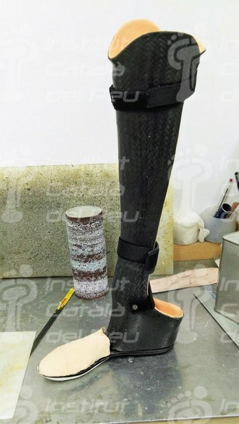 PROSTHESIS FOR CHOPARD’S AMPUTATION