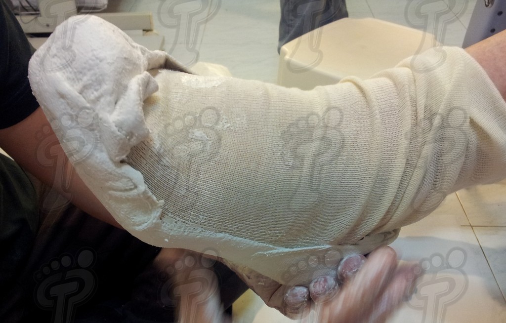 Moldes negativos del pie mediante la aplicación de un termoplástico