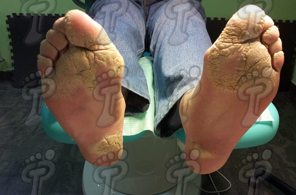 Sistemes avançats en l’anàlisi i tractament biomecànic. Curs teòric-pràctic.