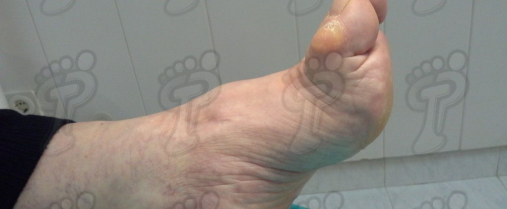 Podiatry Blog