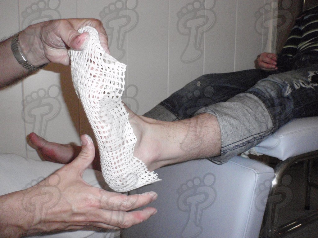 NEGATIVE MOLDS OF FOOT THROUGH THE APPLICATION OF A THERMOPLASTIC.