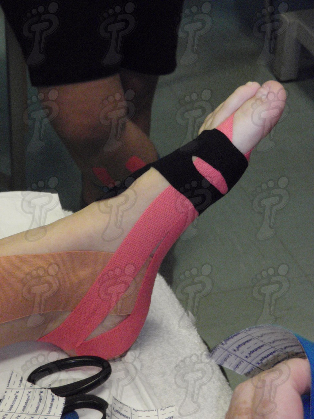 Application of neuromuscular bandages in the lower extremity
