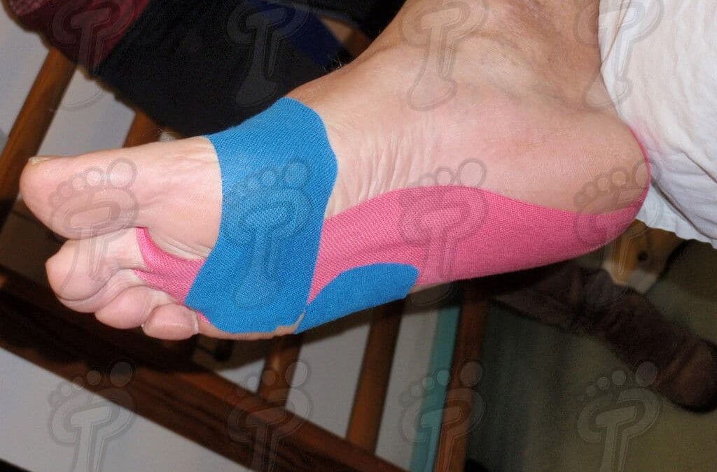 Aplicació d’embenats neuromusculars a l’extremitat inferior