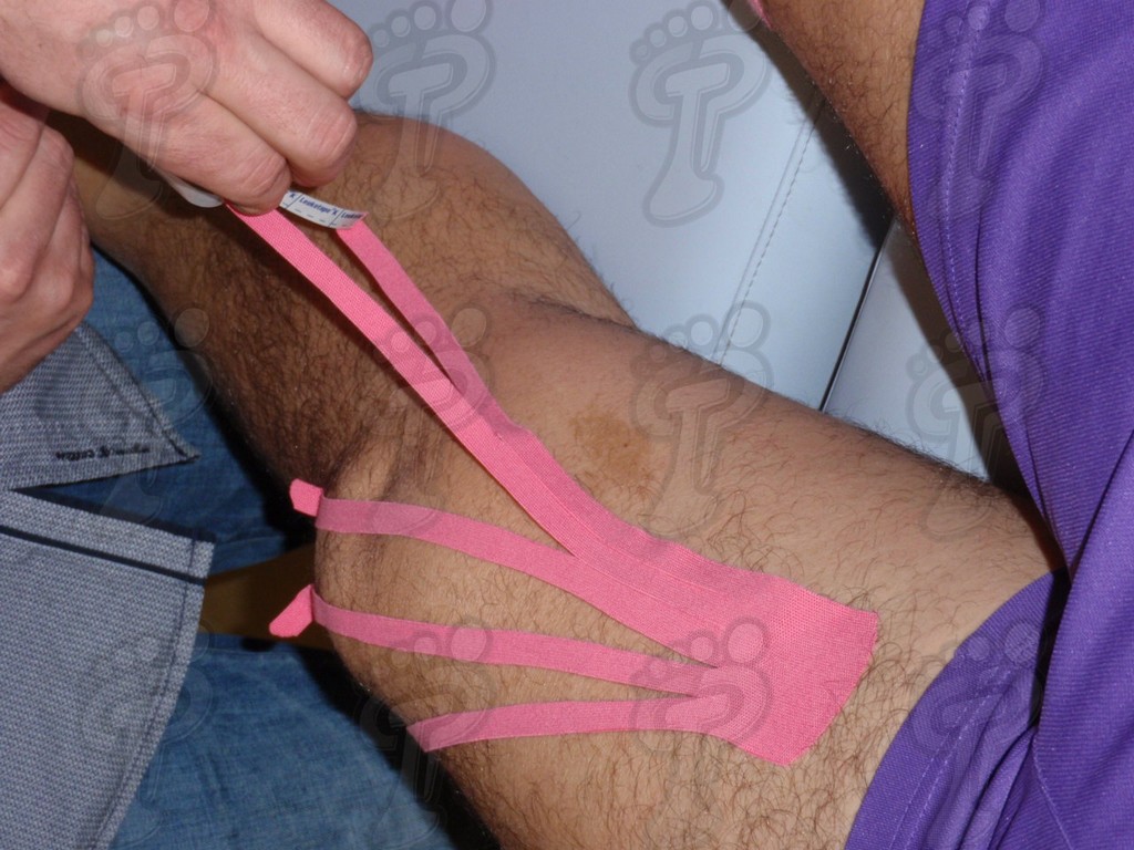 Aplicación de vendajes neuromusculares en la extremidad inferior