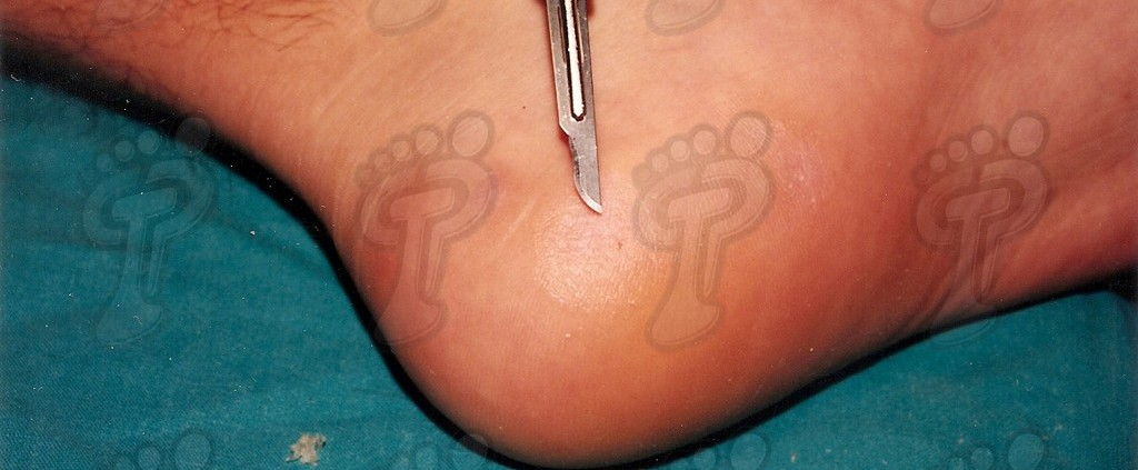 Podiatry Blog