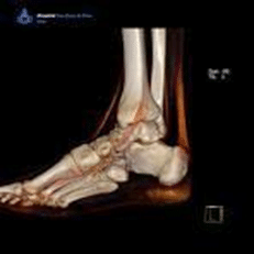 Biomechanics: articulation of the ankle