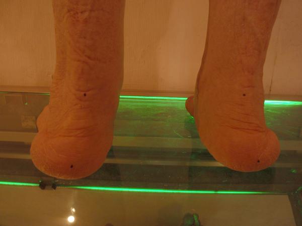 Juanetes y soportes plantares