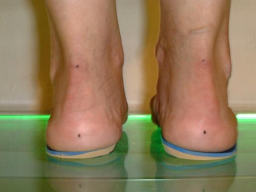 Las plantillas ¿funcionales o inútiles?