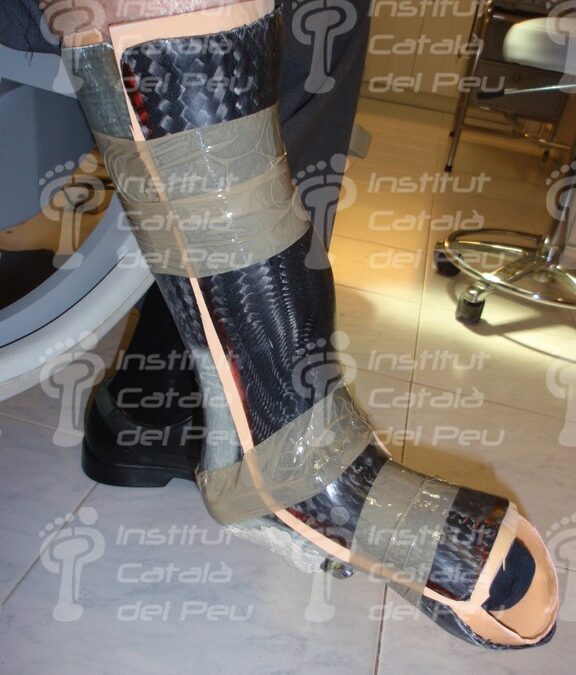 ORTOPROTESIS: CONCEPTOS Y ELABORACIÓN