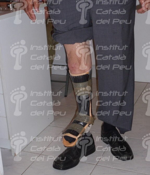 ORTOPROTESIS: CONCEPTES I ELABORACIÓ