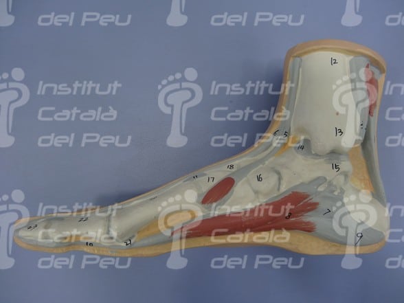 PLANTAR FASCIITIS: SYMPTOMS AND TREATMENT.