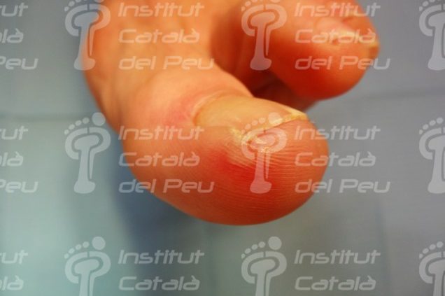 Podiatry Blog Podiatry Blog
