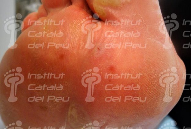 Podiatry Blog