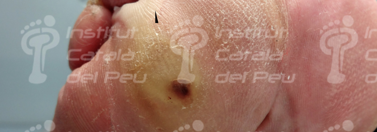 Podiatry Blog