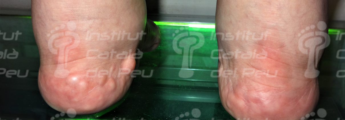 Podiatry Blog
