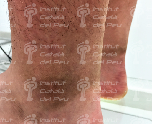 Podiatry Blog