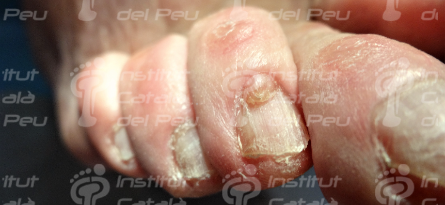 Podiatry Blog