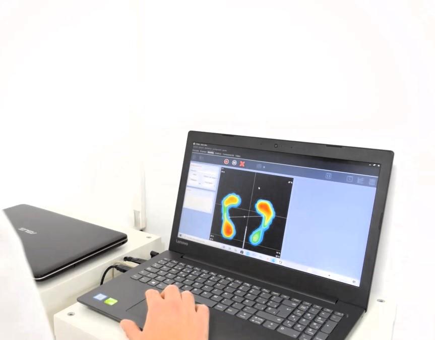 BIOMECHANICS OF THE CYCLIST: THE SIGNIFICANCE OF THE PODIATRY EXAMINATION THROUGH THE BIKE-FIT TECHNIQUE.